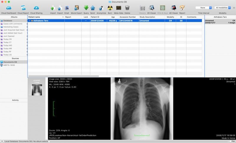 horos dicom viewer for mac